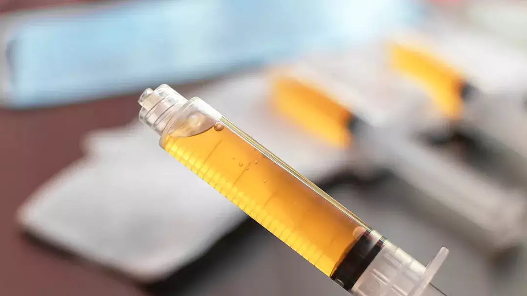 Conselho de Medicina libera técnica com sangue do paciente para artrose