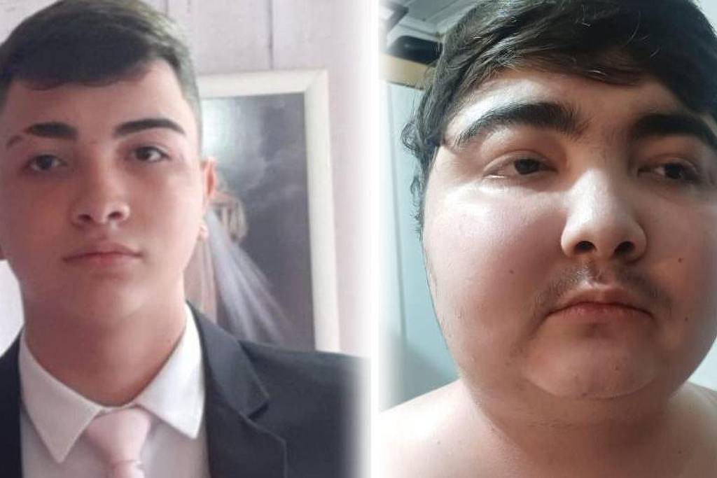 Tumor com menos de um centímetro fez adolescente ganhar 40 quilos em 6 meses