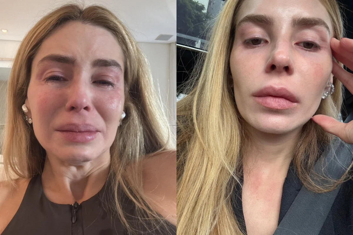 Atriz Joana Cabral revela alopecia após uso de anabolizante