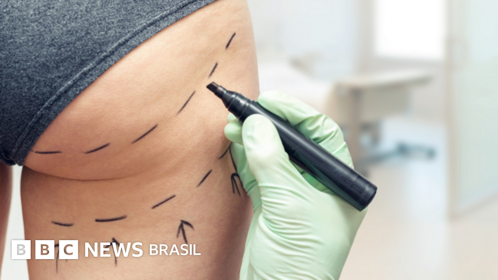 O lado sombrio do 'boom' de lifting de bumbum brasileiro