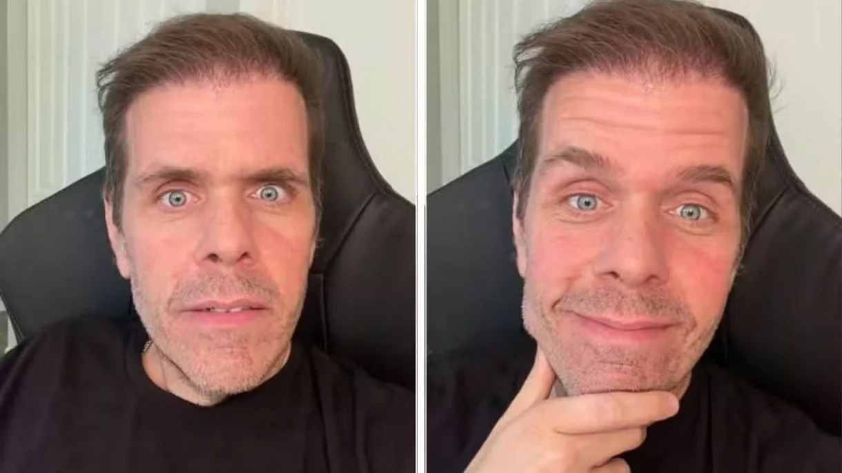 Influenciador Perez Hilton é internado após live com automutilação