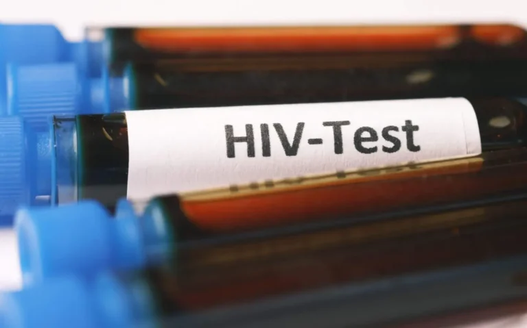 As lacunas de testes de HIV em jovens gays, segundo este estudo