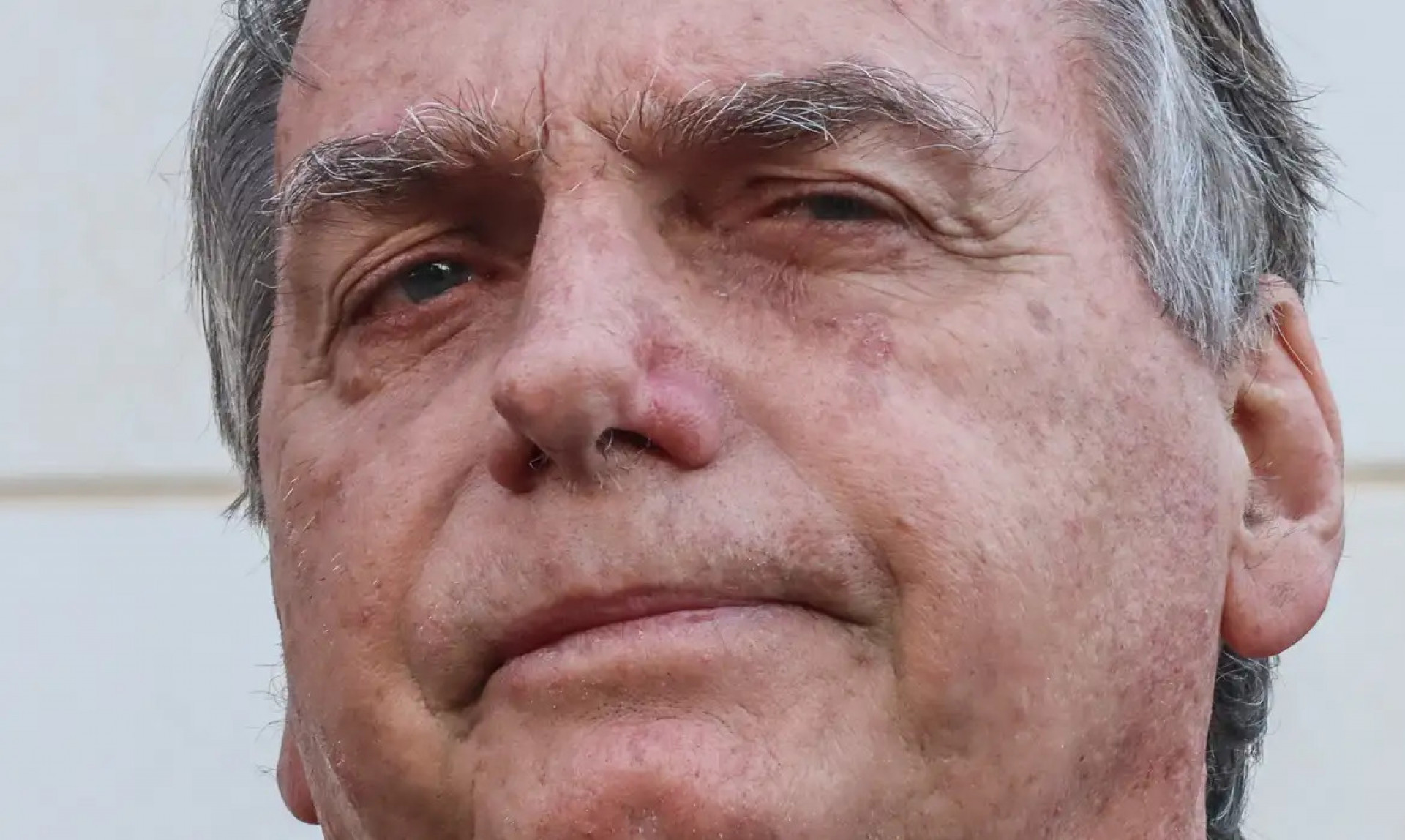 Boletim médico: Bolsonaro tem picos de pressão alta durante a semana