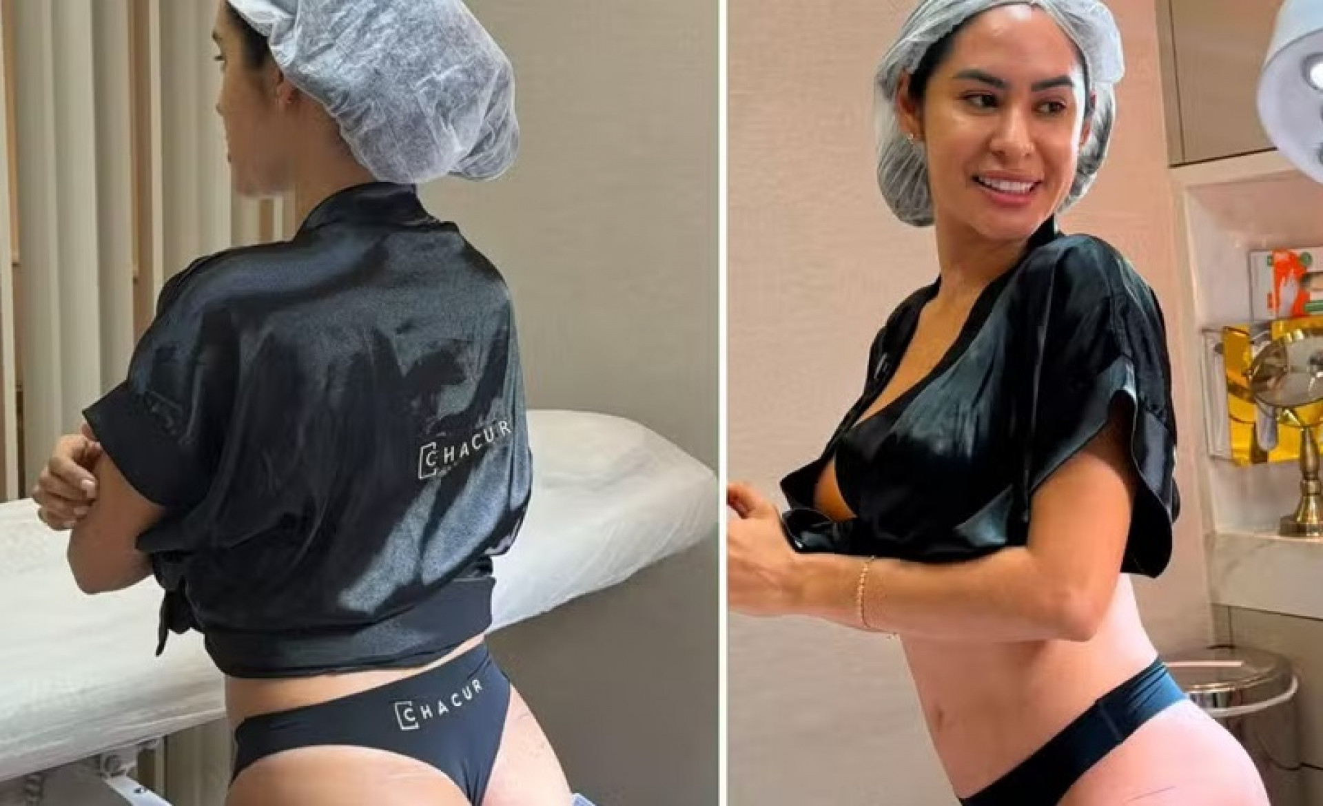Ex-BBB Isabelle Nogueira exibe novo contorno dos glúteos após procedimento