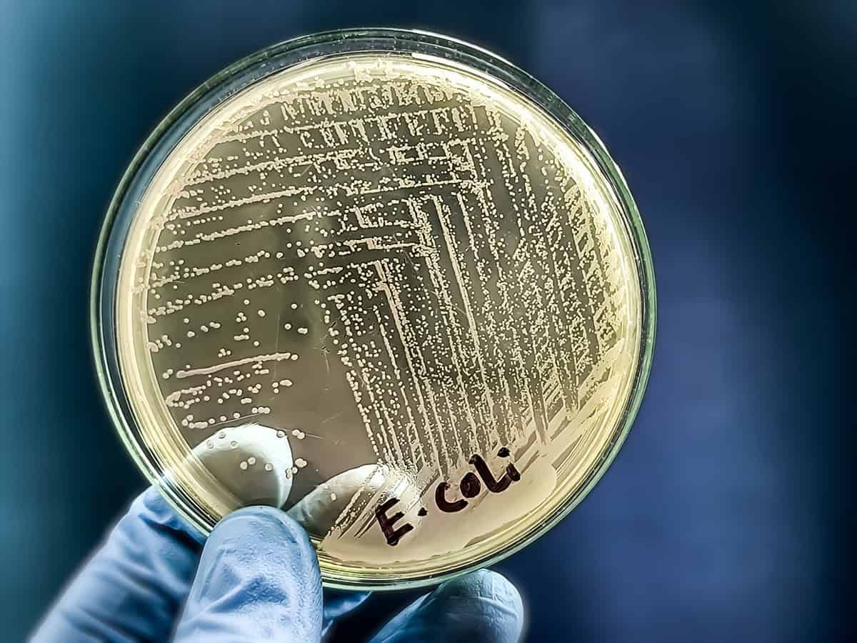 Superbactérias perdem vantagem com novo teste criado por pesquisadores da USP