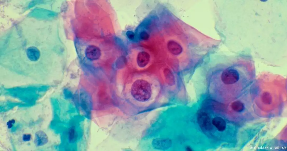 Os entraves para o avanço da vacinação contra o HPV no Brasil