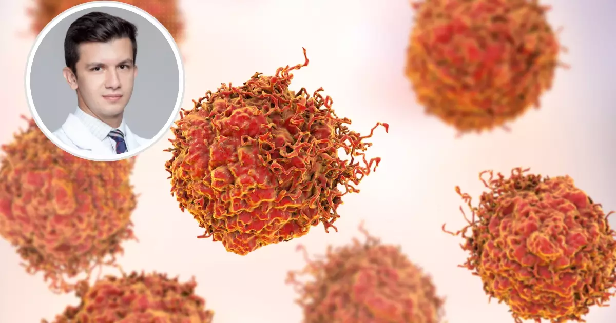 Novo tratamento para câncer de próstata avançado: oncologista explica quem pode se beneficiar