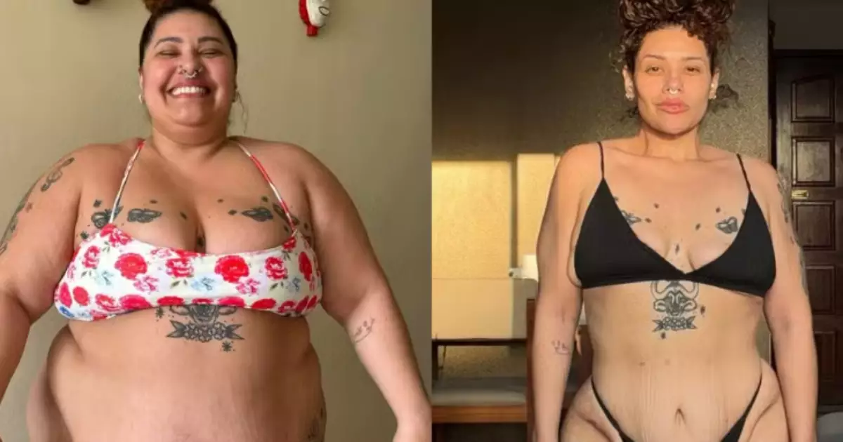 Ex-The Voice mostra cicatrizes de abdominoplastia após perder 90 kg: 'Coragem de ser eu mesma'