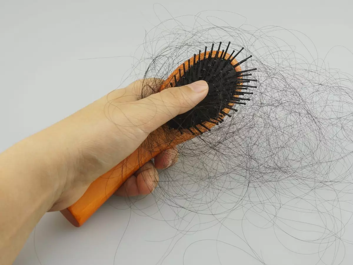 Por que o cabelo cai? Entenda queda de fios