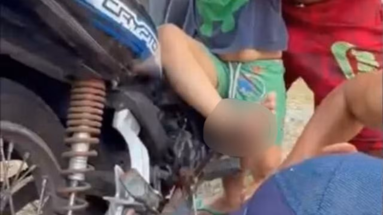 Menino de 4 anos tem pé perfurado e preso em pedal de motocicleta após veículo tombar no AM