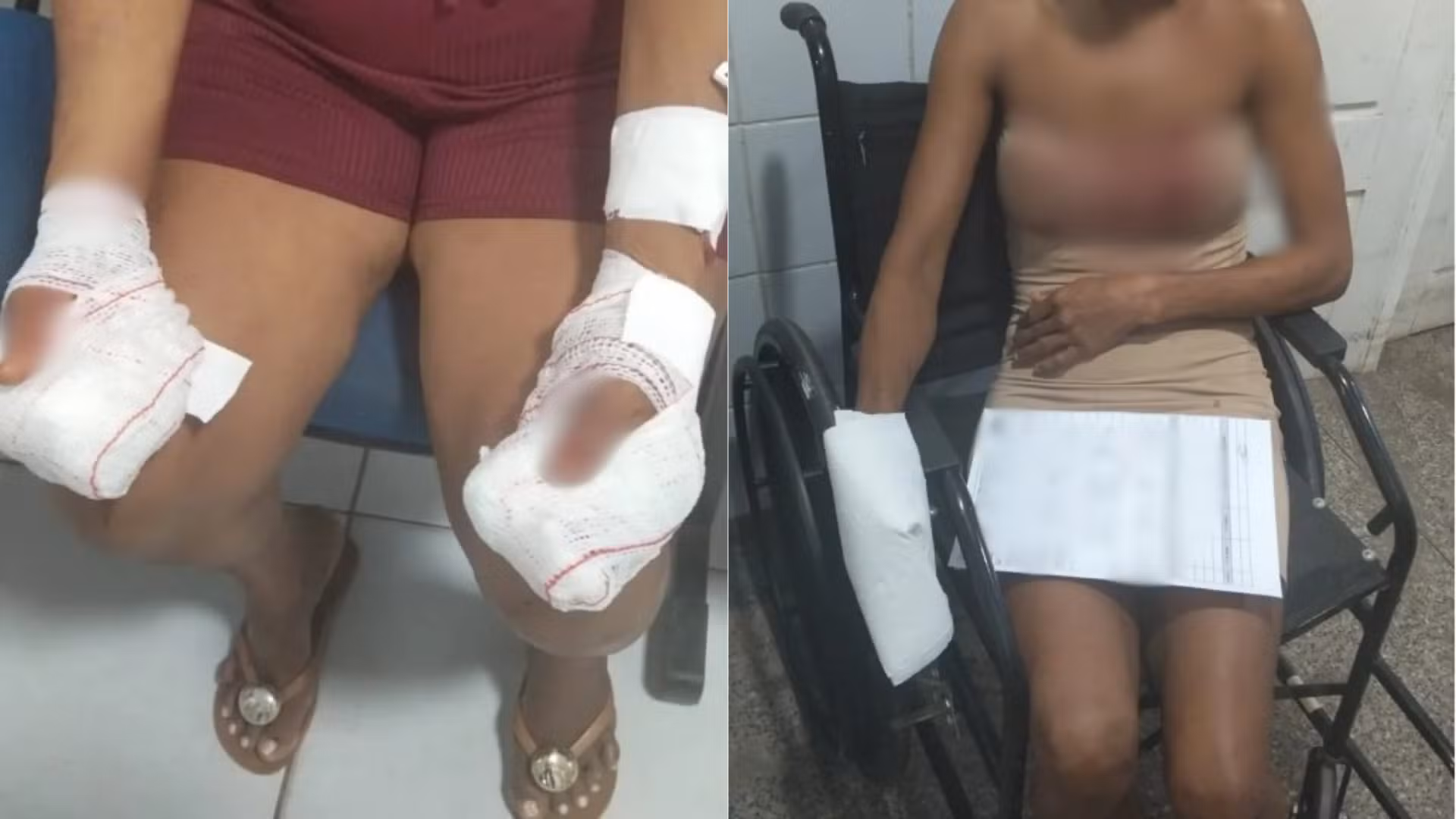 Homem é preso suspeito de agredir a mãe e a própria namorada em Codó; uma das vítimas perdeu alguns dedos