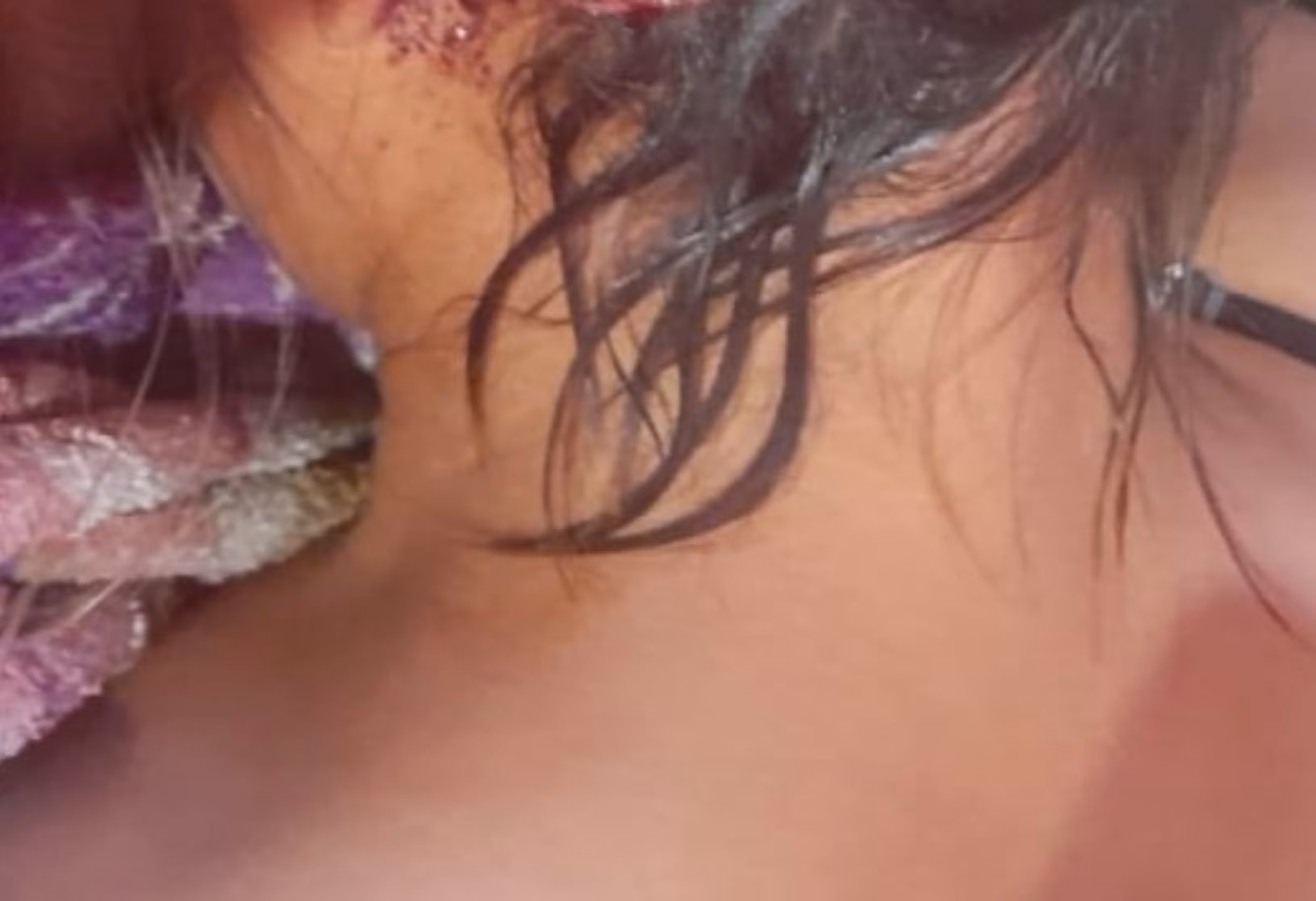 Adolescente é atacada com facão na nuca em comunidade no Bonfim, ao Norte de Roraima