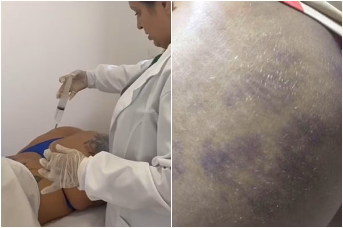 Falsa médica presa em João Pessoa pode responder por pelo menos quatro crimes, afirma delegado