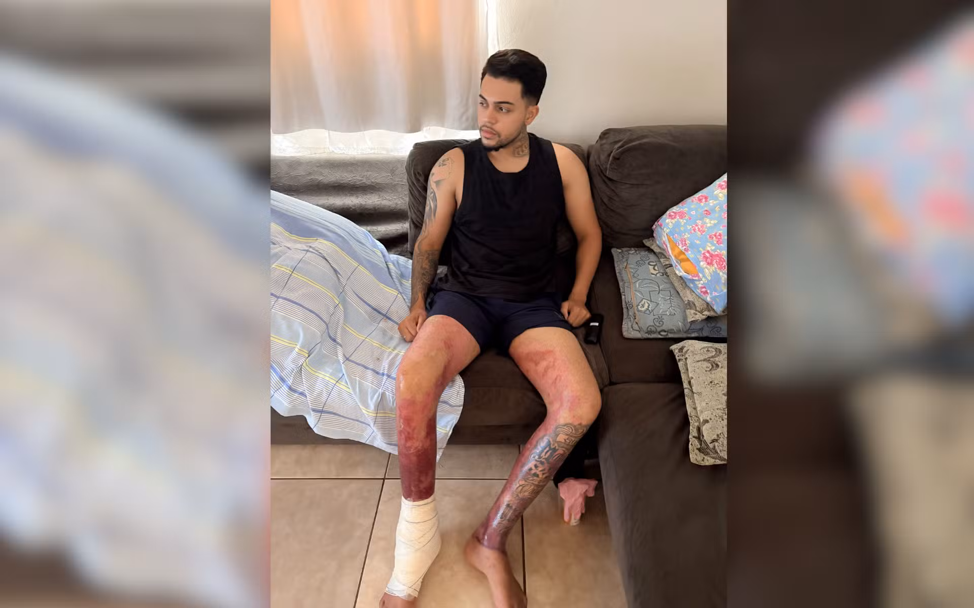 Jovem que teve queimaduras após explosão causada por etanol em tacho
recebe alta de hospital: 'Tempo de recuperação'