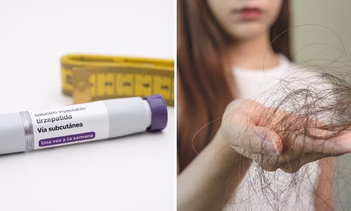 Queda de cabelo com canetas emagrecedoras: por que ocorre e como prevenir