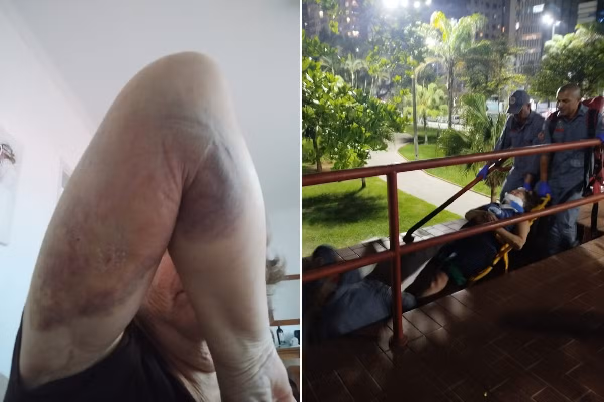 Guarda-corpo cede e mulher cai de escadaria durante exercício na orla de Santos