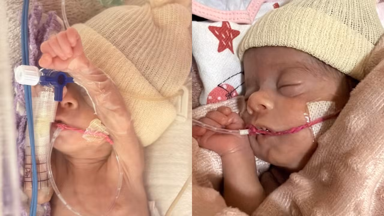 'Guerreirinha': bebê que chegou a pesar 620 gramas supera fase crítica após mais de 60 dias na UTI neonatal