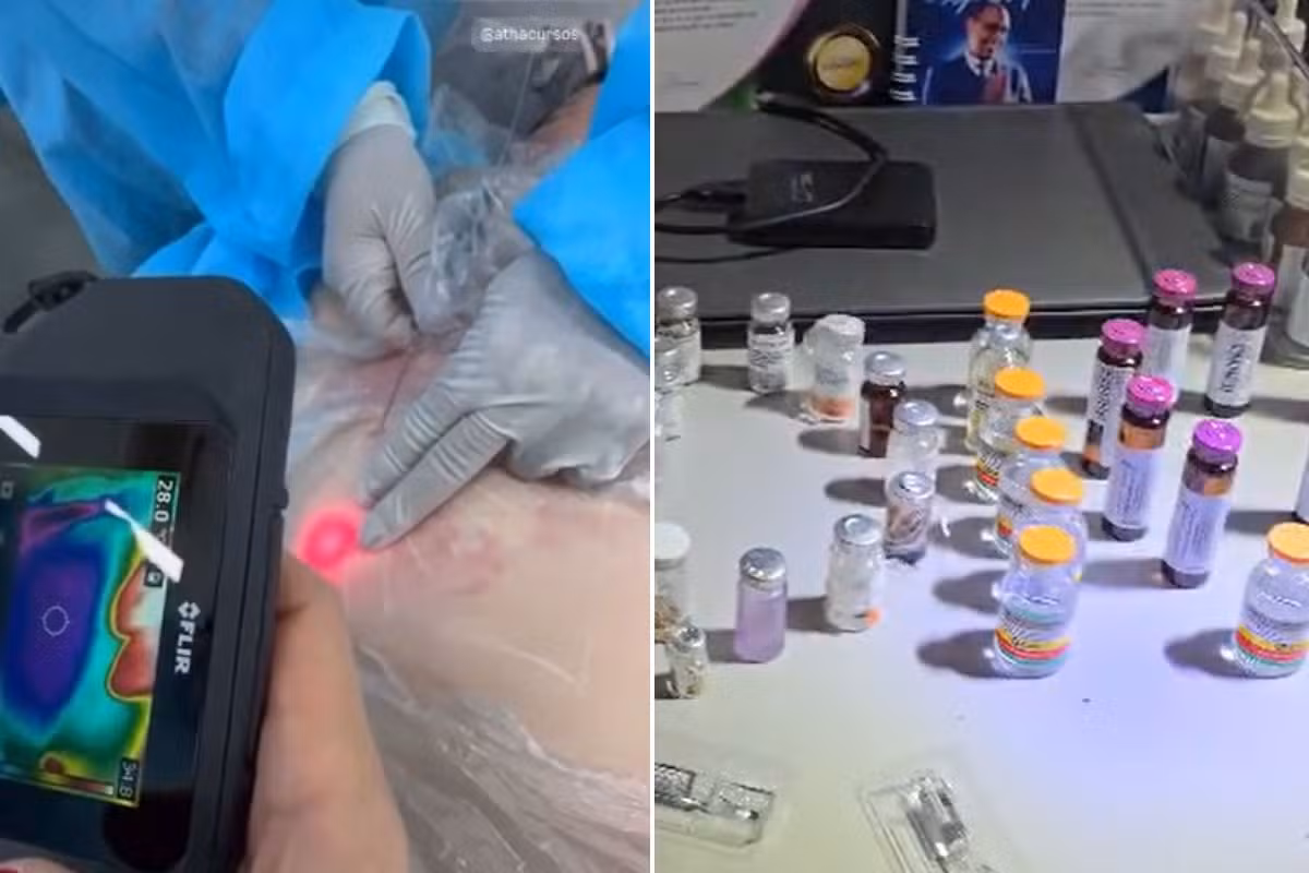Mulher é presa por realizar procedimentos estéticos em clínica clandestina no litoral de SP; VÍDEO