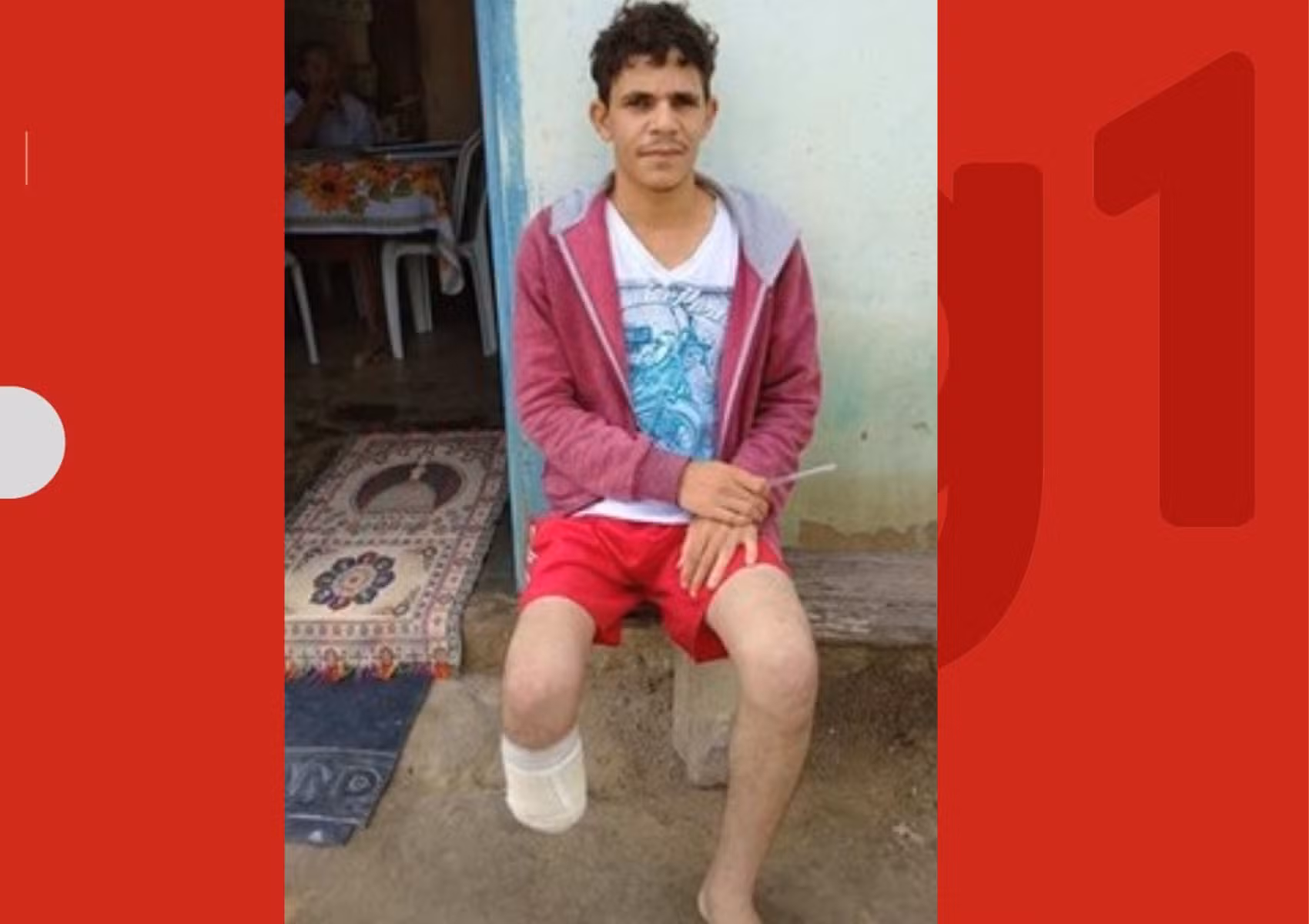 Pé de servidor que amputou o próprio membro para receber R$ 1,5 milhão foi encontrado dentro da mochila dele
