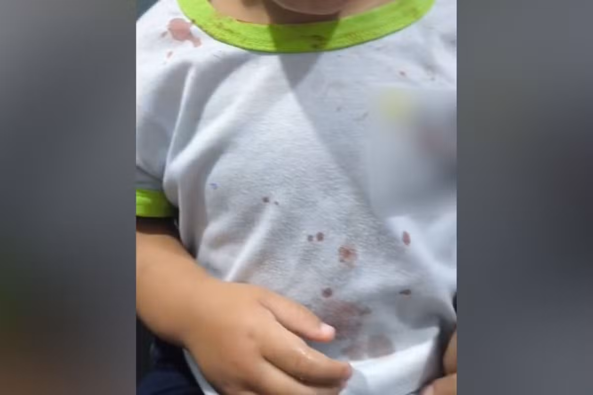 Justiça decide que deve continuar preso padrasto de criança que chegou à CMEI com ferimentos e camisa com manchas de sangue