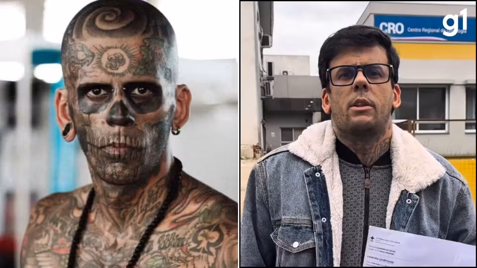 Cirurgia do 'homem mais tatuado do Brasil' será decisiva para definir gravidade de tumor na bexiga