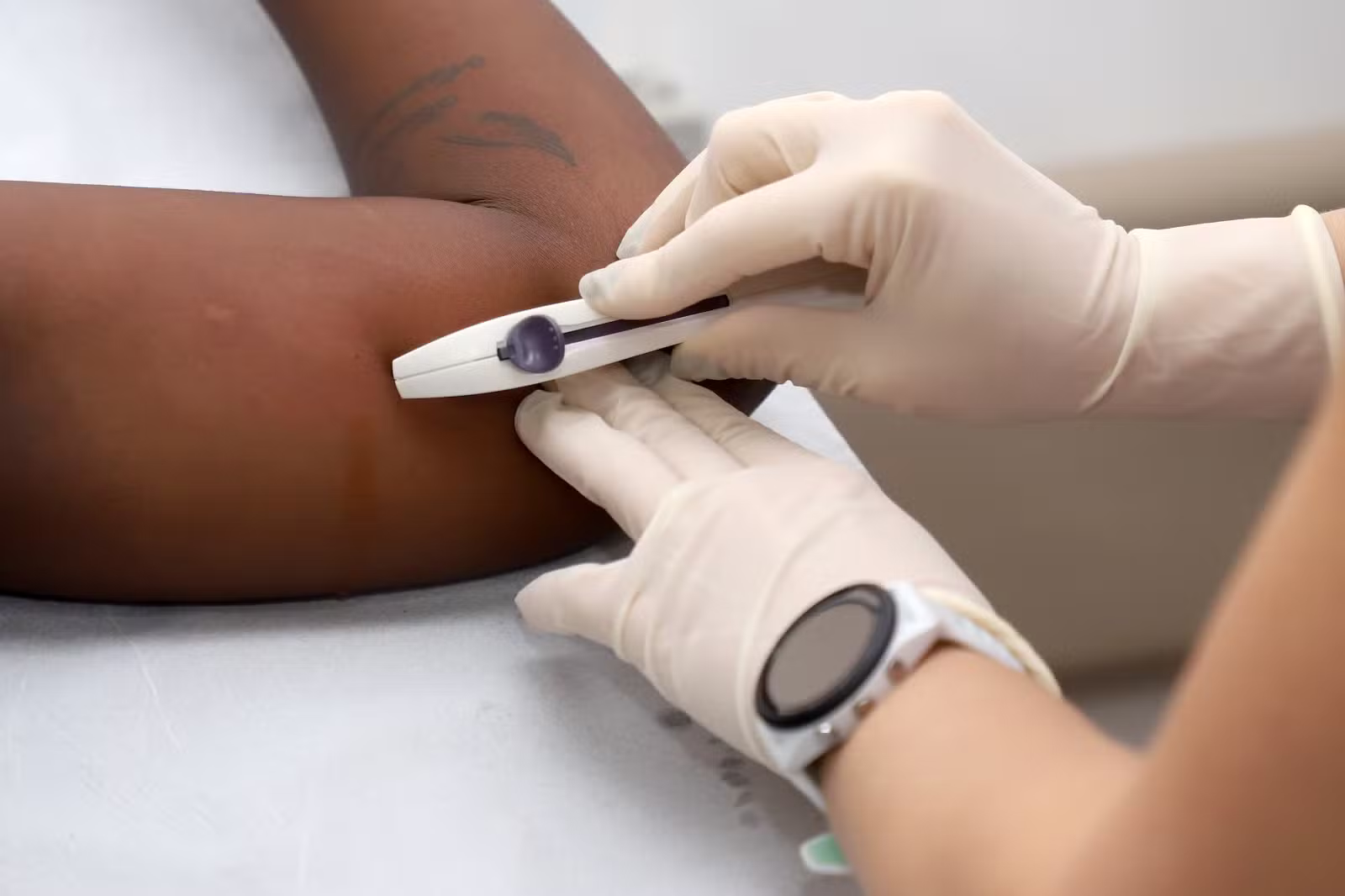 Implantes anticoncepcionais: uso cresce 553% em Campinas após ampliação do acesso na rede pública