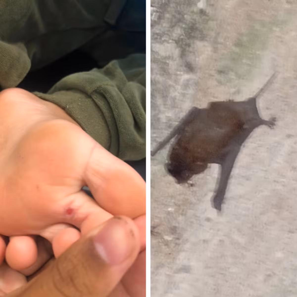 Criança é picada por morcego escondido dentro de sapato e recebe soro antirrábico