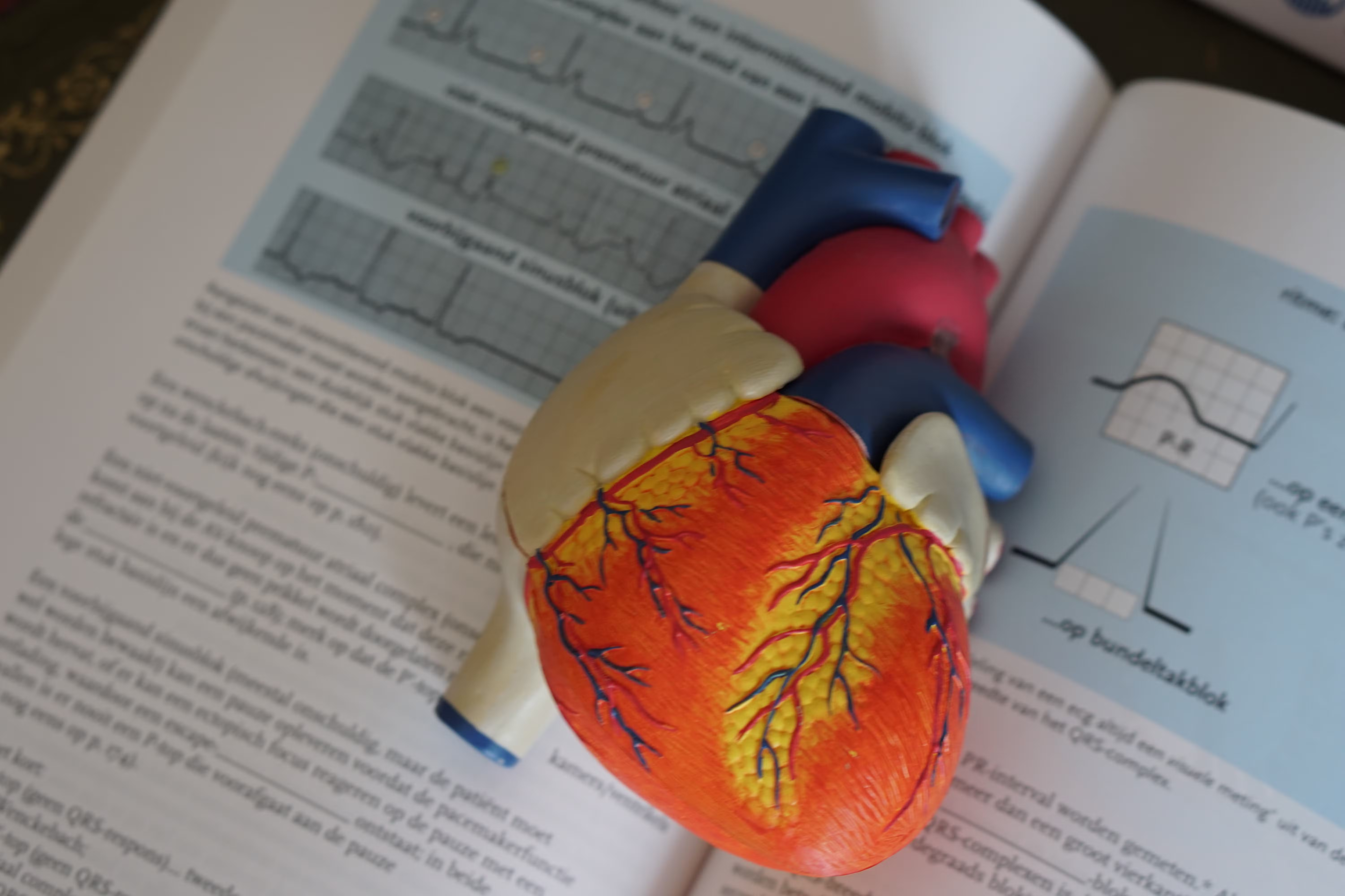 O colesterol de origem genética que a estatina não baixa (e que pode triplicar o risco de infarto)
