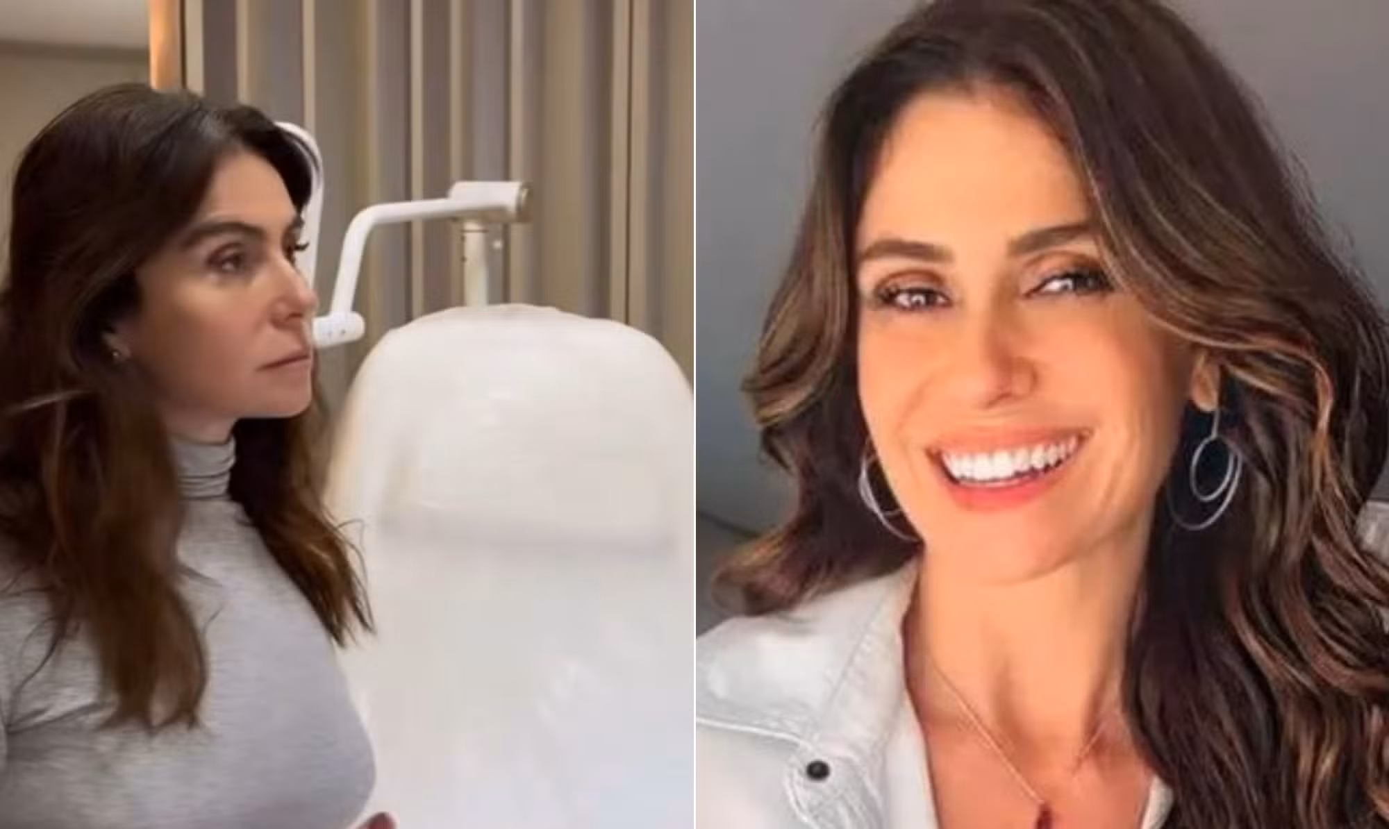 Giovanna Antonelli faz procedimento íntimo a laser; entenda para que serve e como funciona