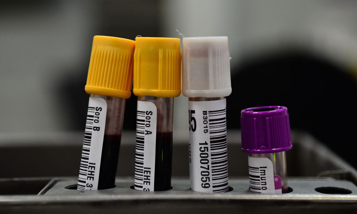 Molécula reduz danos causados por infarto em estudo com ratos