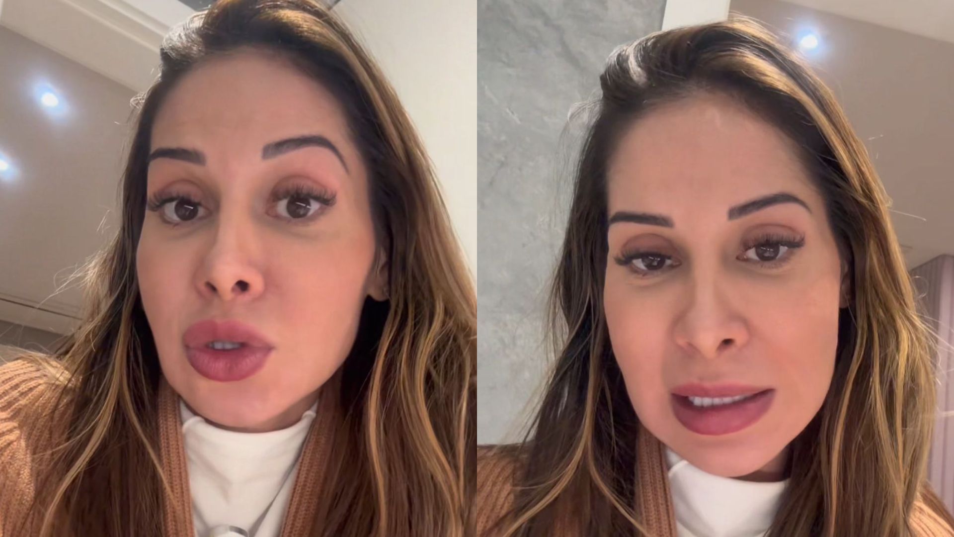 Maíra Cardi expõe sequela de PMMA no rosto e descarta cirurgia: “É para vocês acordarem”